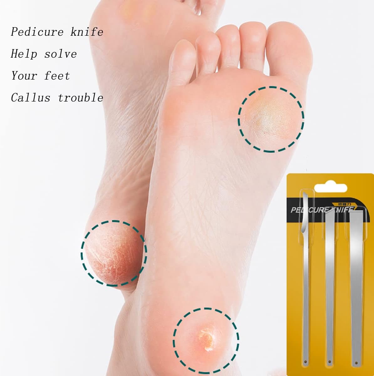 3PCS Stainless Steel Ingrown Toenail Pedicure Knife Set – Professional Foot Care Kit for Corn, Callus, and Paronychia Treatment