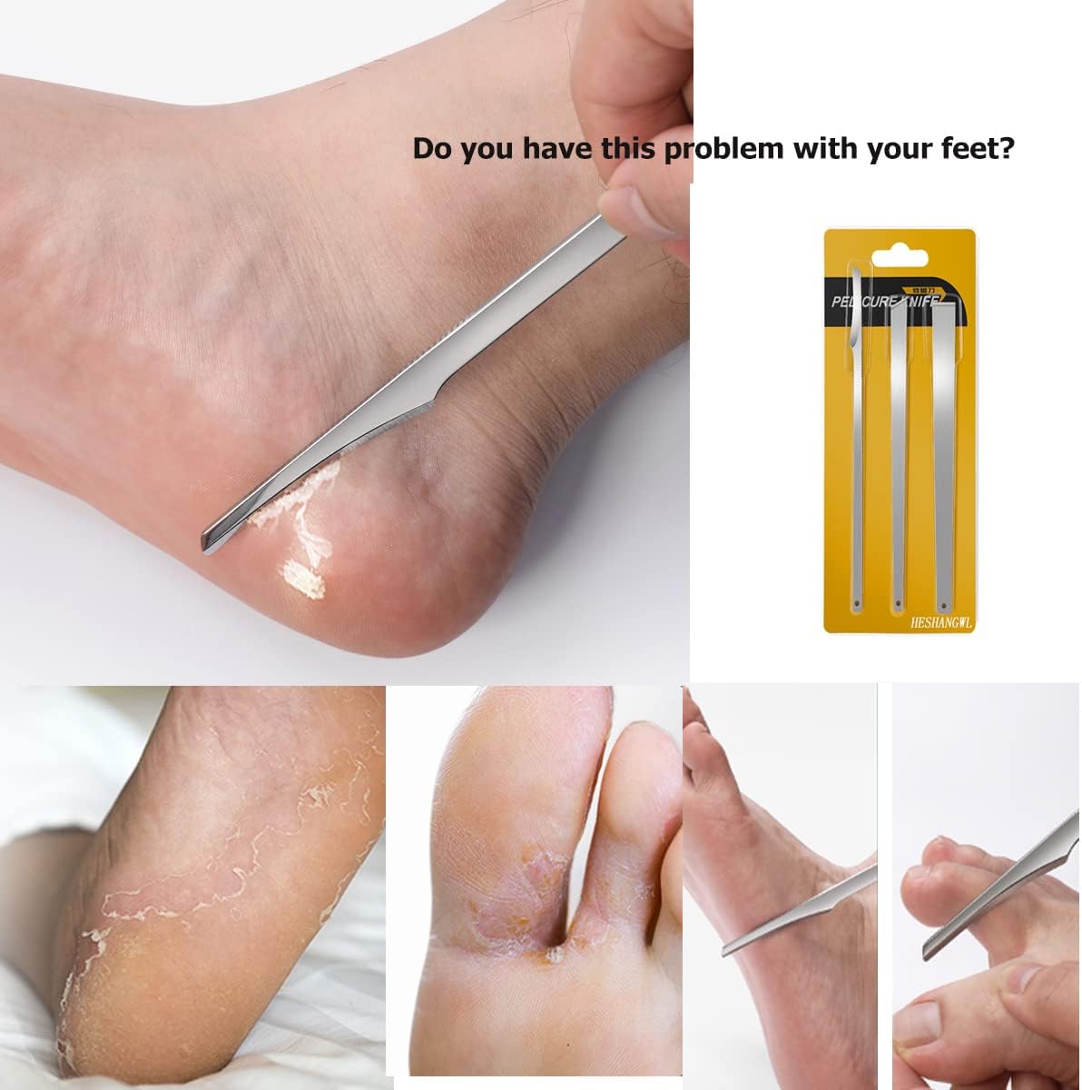 3PCS Stainless Steel Ingrown Toenail Pedicure Knife Set – Professional Foot Care Kit for Corn, Callus, and Paronychia Treatment