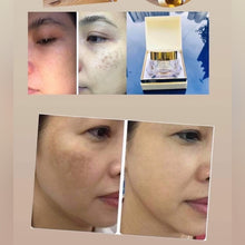Load image into Gallery viewer, [Cell:Ula] Retinol RC Crem 50ml
