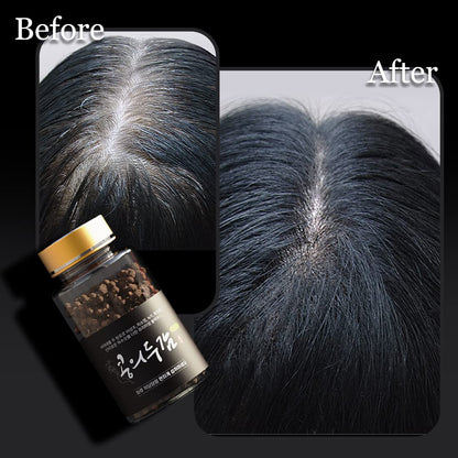 [ROOTONIX] Anti-Hair loss, Black Bean Pillet 100g x 3 (Ha Thu O)